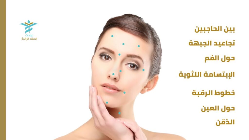 اماكن حقن البوتكس