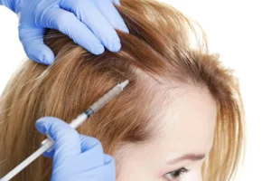 Read more about the article الميزوثيرابى للشعر