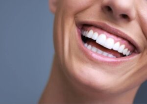 Read more about the article ابتسامة هوليود: خطواتها وأهم فوائدها وأضرارها
