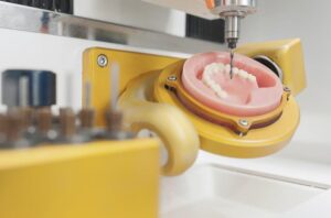 Read more about the article تقنية CAD/CAM لتصميم وتركيب الأسنان