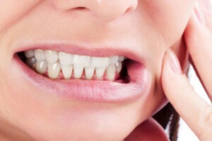 Read more about the article صرير الأسنان: الأسباب والأعراض