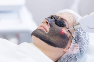 Read more about the article فوائد الليزر الكربوني للبشرة الدهنية