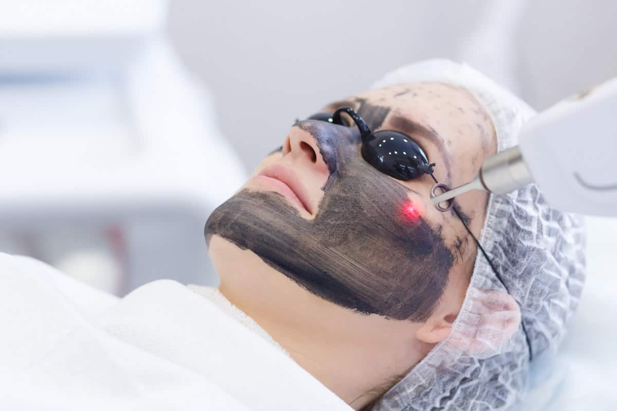 You are currently viewing فوائد الليزر الكربوني للبشرة الدهنية