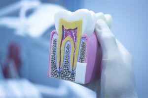 Read more about the article تقنيات علاج جذور الأسنان المتقدمة